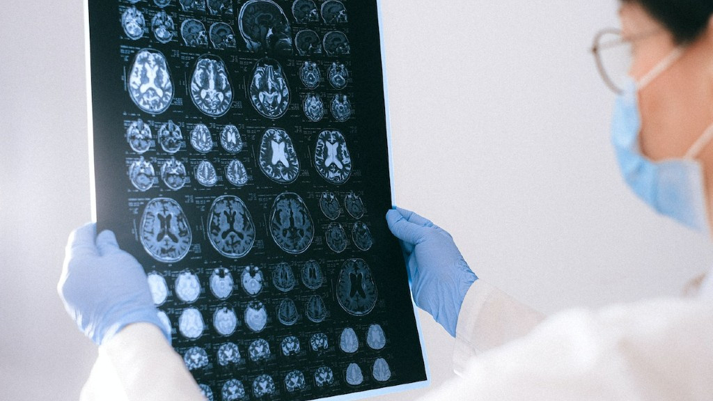 There are a wide range of applications for big data and artificial intelligence in CT scans, X-rays, ultrasound and magnetic resonance imaging (photo: Anna Shvets: / Pexels)